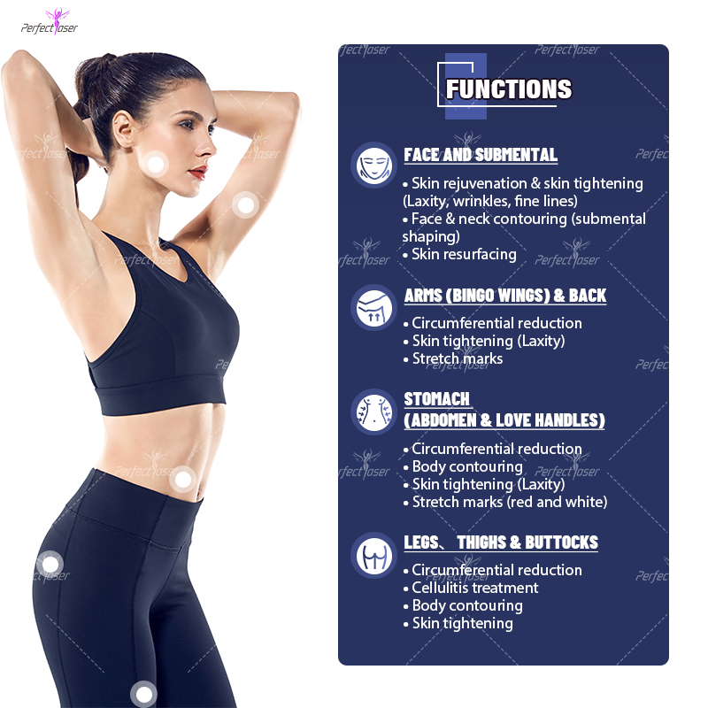 Perfectlaser 4 in 1 Vela Body  - đánh giá và giá Vacuum Cavitation Body Contouring