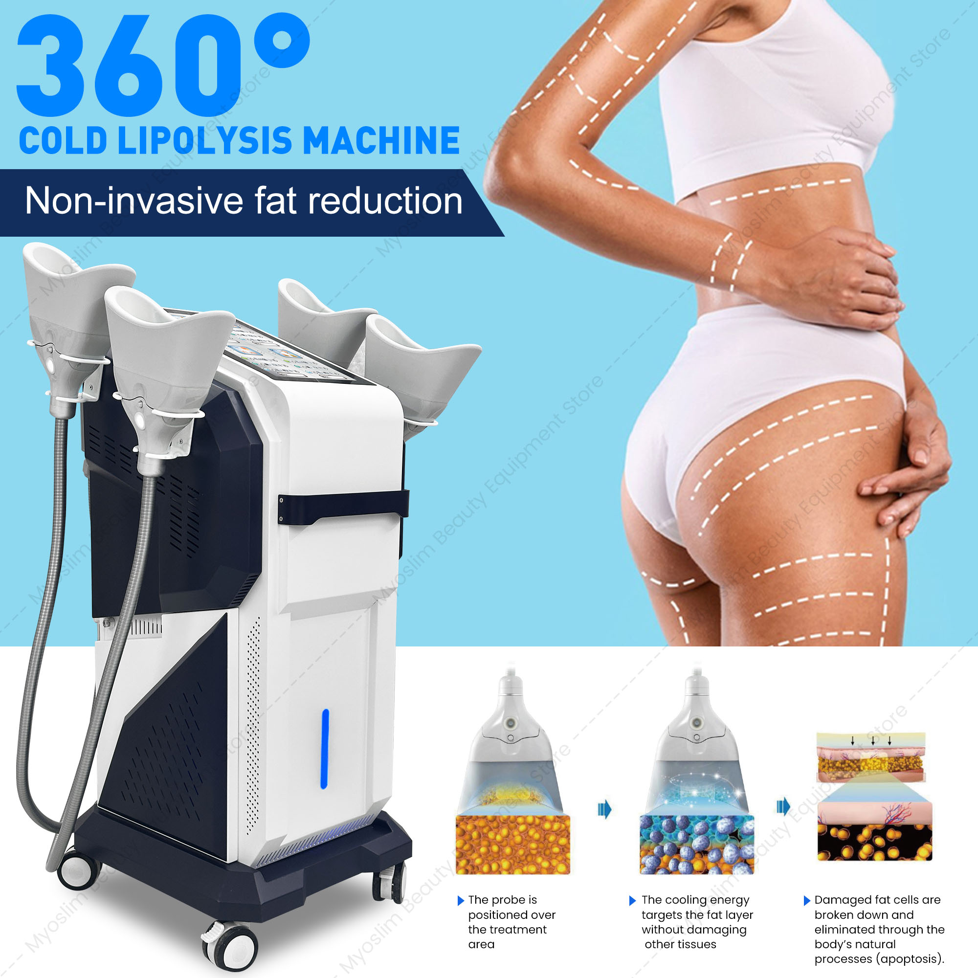 360° 4‑Channel Cryolipolysis F - đánh giá và giá Cryolipolysis Fat Freezing Machine