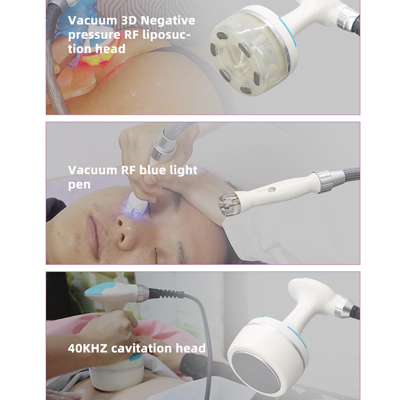 New Professional V-TEM Body Co - đánh giá và giá Vacuum Cavitation Body Contouring